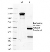 SDS-PAGE Analysis of Purified, BSA-Free IGF1 Antibody (clone M23). Confirmation of Integrity and Purity of the Antibody.
