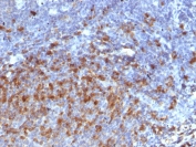 IHC staining of FFPE human tonsil with anti-IgG antibody. HIER: boil tissue sections in pH 9 10mM Tris with 1mM EDTA for 10-20 min and allow to cool before testing.