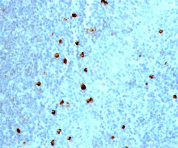 IHC testing of human tonsil stained with IgM heavy chain antibody.