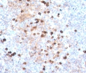 IHC testing of human tonsil stained with IgM heavy chain antibody (clone IM373).