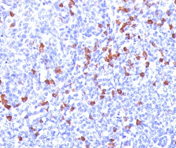 IHC: Formalin/paraffin human tonsil stained with Kappa Light Chain antibody (clone L1C1). Note cell membrane & cytoplasmic staining.~