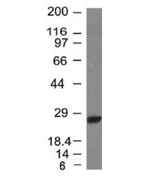 Western blot testing of Raji lysate with Kappa Light Chain antibody (clone L1C1).