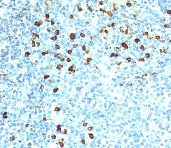 IHC testing of human tonsil stained with Kappa antibody (clone KLC264). Note cell membrane & cytoplasmic staining.~