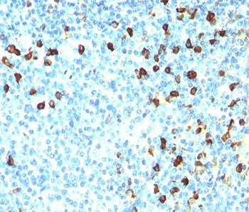 IHC: Formalin/paraffin human tonsil stained with Lambda Light Chain antibody (ICO106).~