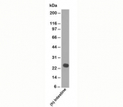 Western blot testing of human samples using Lambda Light Chain antibody (LcN-2).