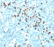 IHC testing of tonsil stained with Lambda Light Chain antibody (LcN-2). Note cell membrane & cytoplasmic staining.