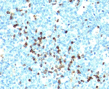 IHC testing of human tonsil stained with Lambda Light Chain antibody cocktail (LcN-2 + ICO-106).~