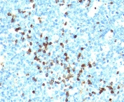 IHC testing of human tonsil stained with Lambda Light Chain antibody cocktail (LcN-2 + ICO-106).