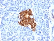 Insulin antibody E2-E3 or INS04 immunohistochemistry pancreas