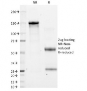SDS-PAGE Analysis of Purified, BSA-Free CD11a Antibody (clone CRIS-3). Confirmation of Integrity and Purity of the Antibody.