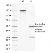 SDS-PAGE Analysis of Purified, BSA-Free Integrin Beta 4 Antibody (clone UM-A9). Confirmation of Integrity and Purity of the Antibody.