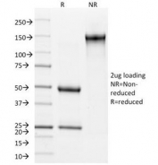 SDS-PAGE Analysis of Purified, BSA-Free Involucrin Antibody (clone SY5). Confirmation of Integrity and Purity of the Antibody.