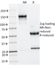 SDS-PAGE Analysis of Purified, BSA-Free Cytokeratin 6 Antibody (clone LHK6). Confirmation of Integrity and Purity of the Antibody.