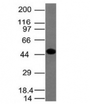 Western blot testing of human A431 lysate with Cytokeratin 8 antibody (clone H1).