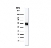 Western blot testing of human HCT-116 lysate with Cytokeratin 8 antibody.