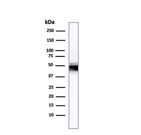 Western blot testing of human HCT-116 lysate with Cytokeratin 8 antibody.
