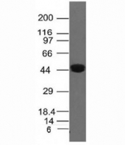 Western blot analysis of Cytokeratin 8 antibody and human A431 lysate. Predicted molecular weight ~56 kDa.