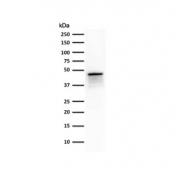 Western blot testing of human SK-O-V3 cell lysate with Cytokeratin 8 antibody.