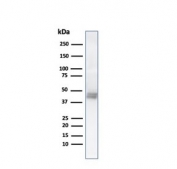 Western blot testing of HCT-116 cell lysate using KRT8 antibody (clone K8.8) at 1ug/ml. Observed molecualr weight: 46~50kDa.