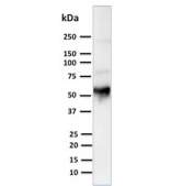 Western blot testing of human thymus lysate with Cytokeratin 10 antibody. Predicted molecular weight ~59 kDa.