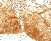 IHC testing of FFPE human prostate with Cytokeratin 14 antibody (clone LL002)