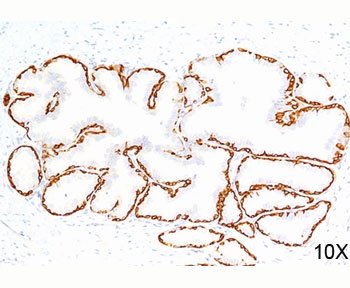 IHC testing of human prostate (10X) stained with Cytokeratin 14 antibody (LL002).