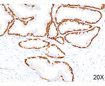 IHC testing of human prostate (20X) stained with Cytokeratin 14 antibody (LL002).