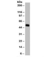 Western blot testing of A431 cell lysate (epidermoid carcinoma) and Cytokeratin 14 antibody (clone LL002) at 1ug/ml. Predicted/observed molecular weight: ~53kDa.