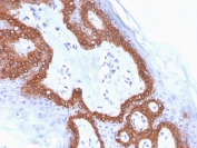 IHC staining of FFPE human skin with Cytokeratin 14 antibody (clone LL002). HIER: boil tissue sections in pH 9 10mM Tris with 1mM EDTA for 20 min and allow to cool before testing.