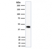 Western blot testing of human HCT116 cell lysate using Cytokeratin 18 antibody (clone DC10). Predicted molecular weight ~48 kDa.