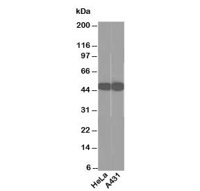 Western blot testing of human HeLa and A431 cell lysate using Cytokeratin 18 antibody (clone DC10). Predicted molecular weight ~48 kDa.
