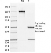 SDS-PAGE Analysis of Purified, BSA-Free L1CAM Antibody (clone UJ127). Confirmation of Integrity and Purity of the Antibody.