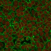Immunofluorescent staining of human MCF7 cells with EpCAM antibody (clone VU-1D9, green) and Nucspot nuclear stain (red).