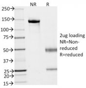 SDS-PAGE analysis of purified, BSA-free EpCAM antibody (clone VU-1D9) as confirmation of integrity and purity.