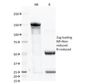 SDS-PAGE Analysis of Purified, BSA-Free CD46 Antibody (clone 122.2). Confirmation of Integrity and Purity of the Antibody.