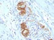 IHC testing of FFPE human colon ganglion tissue stained with NCAM antibody (clone 123C3.D5).