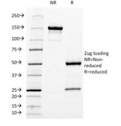 SDS-PAGE Analysis of Purified, BSA-Free Neurofilament Antibody (clone NF421). Confirmation of Integrity and Purity of the Antibody.