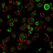 Immunofluorescent staining of permeabilized human HEK293 cells with Neurofilament antibody (clone NF421, green) and Phalloidin (red).