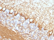 IHC testing of FFPE rat cerebellum with Neurofilament antibody (clone NF421).