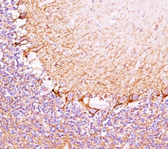 IHC testing of cerebellum stained with Neurofilament Heavy antibody (RT97).~