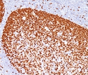 IHC testing of human human tonsil stained with PCNA antibody (PC10).