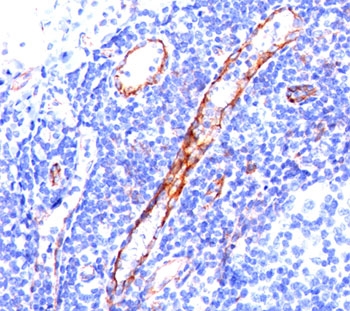 IHC staining of tonsil tissue with CD31 antibody (C31.3).