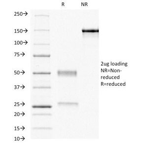 SDS-PAGE Analysis of Purified, BSA-Free Progesterone Receptor Antibody (clone PR484). Confirmation of Integrity and Purity of the Anti