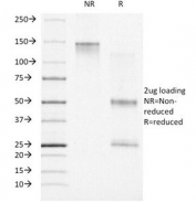 SDS-PAGE Analysis of Purified, BSA-Free Progesterone Receptor Antibody (clone PR500). Confirmation of Integrity and Purity of the Antibody.
