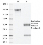 SDS-PAGE Analysis of Purified, BSA-Free Progesterone Receptor Antibody (clone PR501). Confirmation of Integrity and Purity of the Antibody.