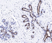 Progesterone Receptor antibody PR501 immunohistochemistry breast 