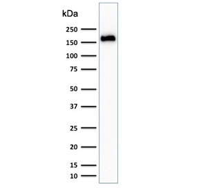 Western blot testing of human HeLa cell lysate with Podocalyxin antibody (clone 3D3). Expected molecular weight: 55-165 kDa depending on level of glycosylation.