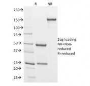 SDS-PAGE analysis of purified, BSA-free Podocalyxin antibody (clone 3D3) as confirmation of integrity and purity.