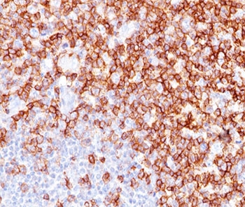 IHC testing of human tonsil stained with CD45RO antibody (UCHL-1).