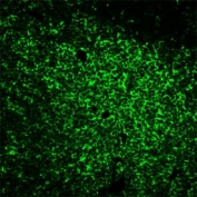 Immunofluorescent staining of FFPE human tonsil tissue with CD45RO antibody (clone UCHL-1).